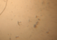 Vido 622 version MPG bactrie vue au microscope
